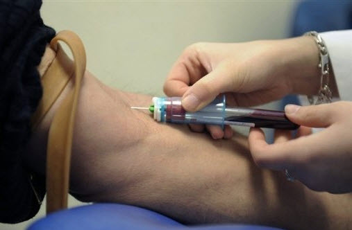 La maladie d'Alzheimer identifiable par test sanguin ? - Source de l'image: http://www.lepoint.f