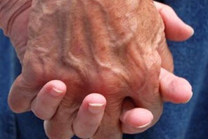 Mobilisation générale pour la Journée mondiale de la maladie d'Alzheimer - Source de l'image : http://images.vedura.fr/